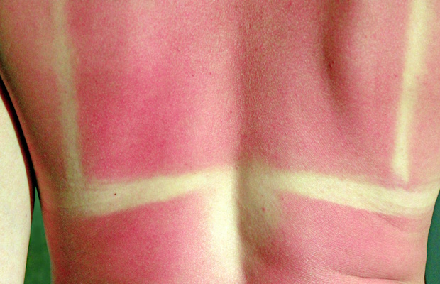 31% of people say this is the worst part of summer. 31% of people say this is the worst part of summer.